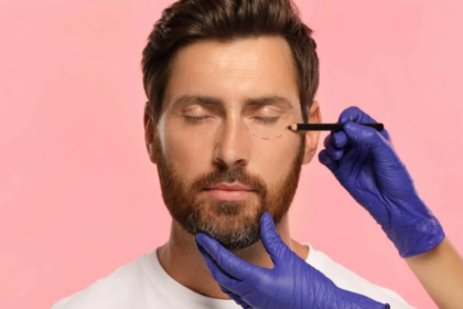 blefaroplastia hombres
