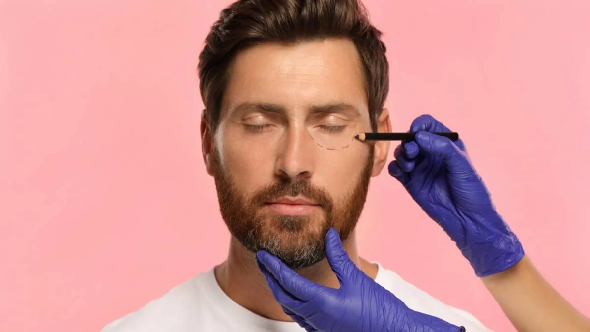 blefaroplastia hombres