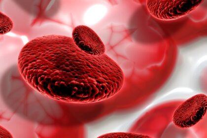 ds hemofilia 1